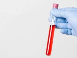 Laboratorijske pretrage