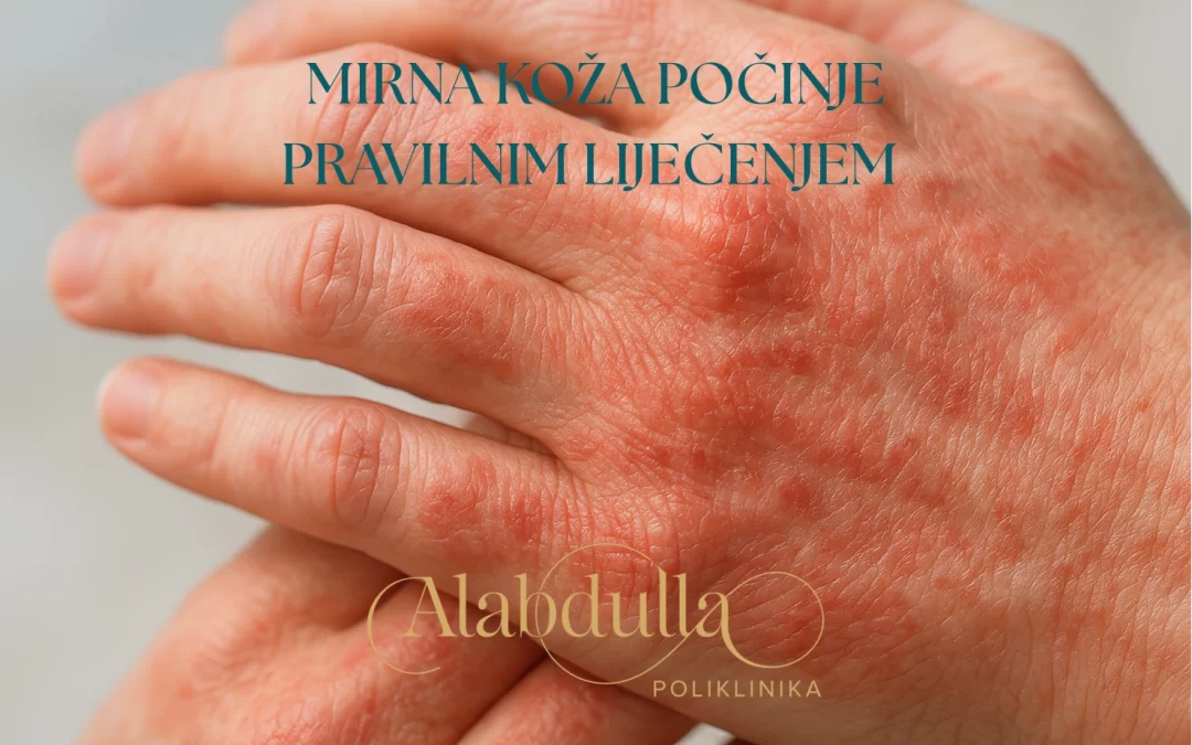 Dermatologija sada u Poliklinici Alabdulla