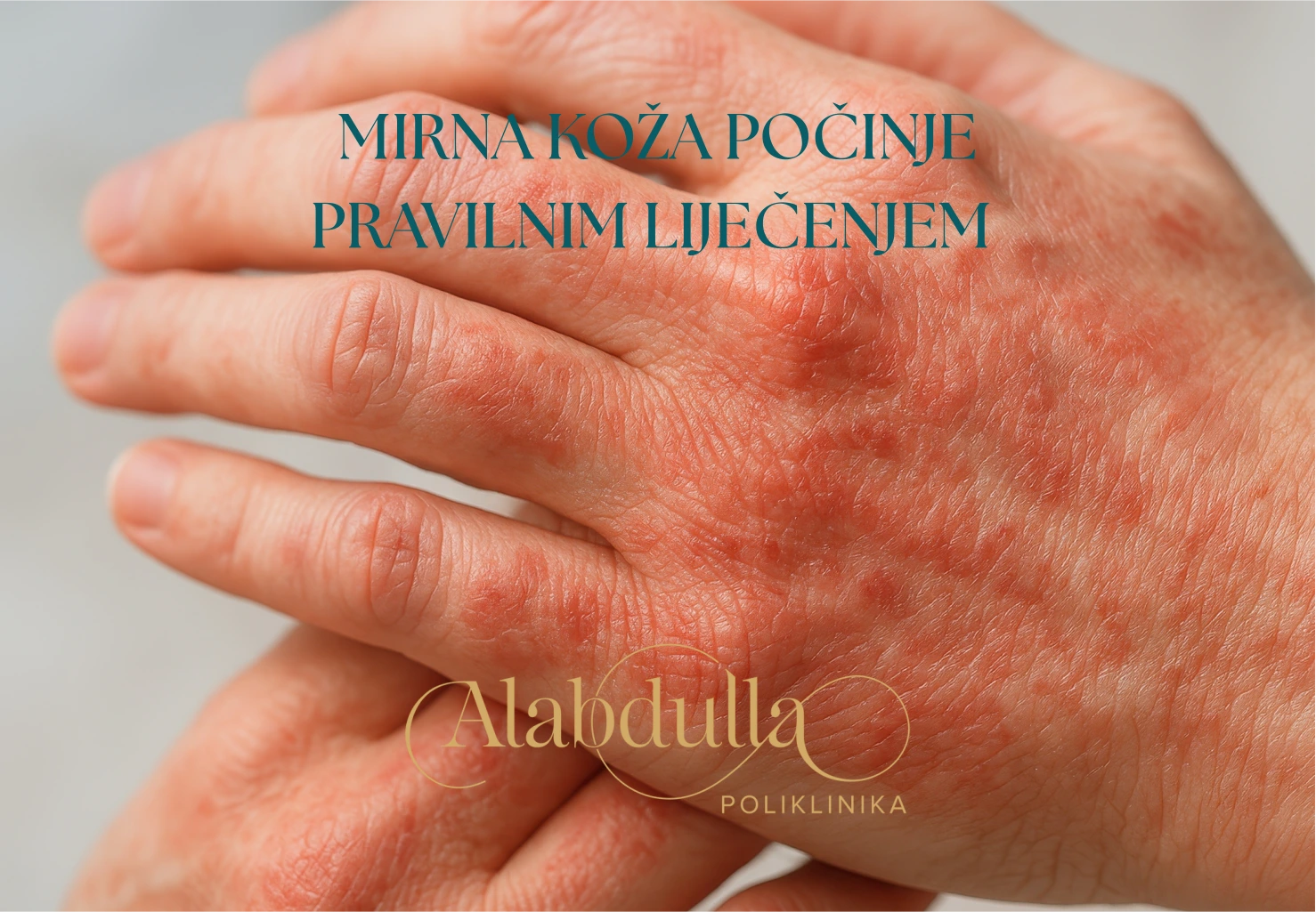 dermatologija lijecenje