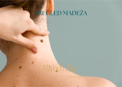 pregled madeza