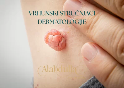 dermatolgija vrhunski strucnjaci