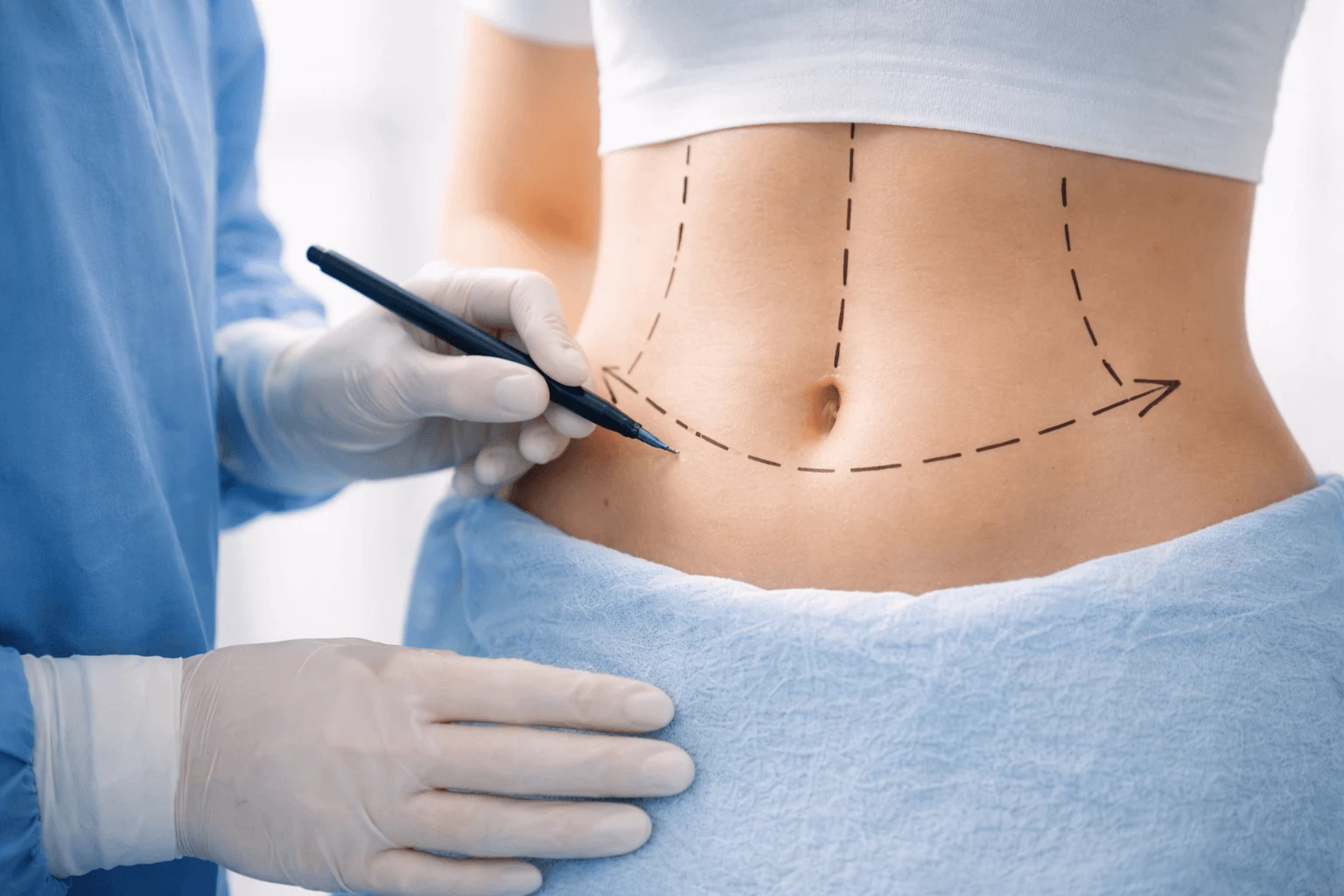 Opća i abdominalna kirurgija